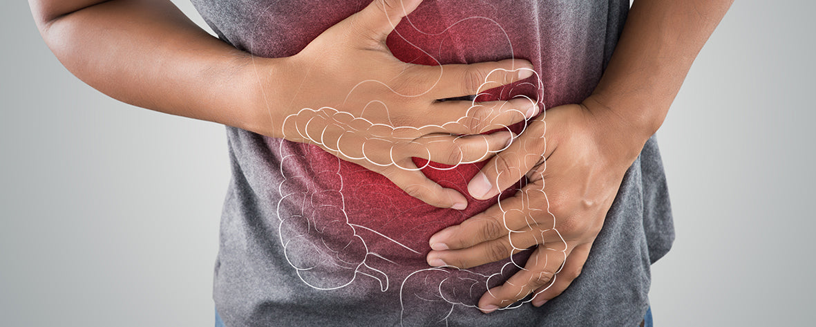 Morbus Crohn & Colitis ulcerosa: Wenn der Darm chronisch entzündet ist